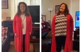 melody s before and after photo